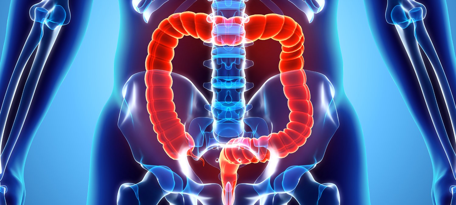 Exray photo of human colon