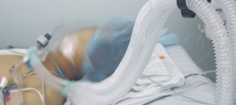 Patient on life support in ICU